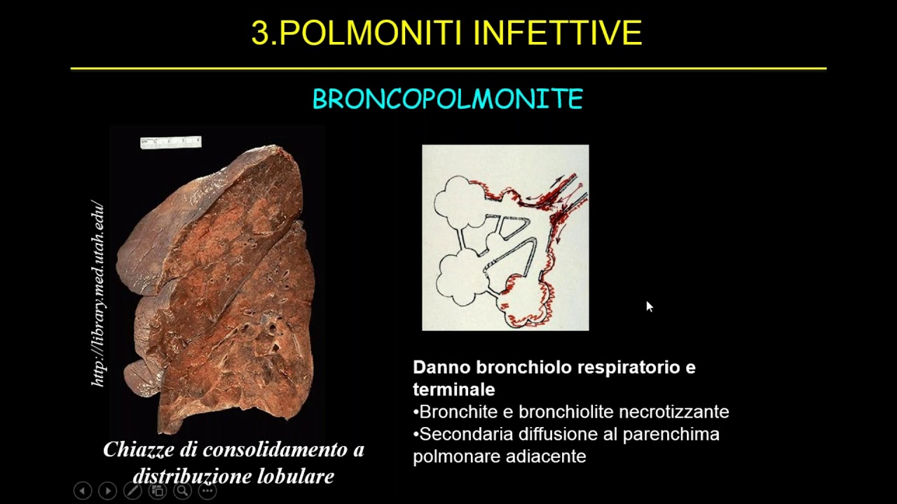Diagnostica per immagini nel paziente respiratorio critico