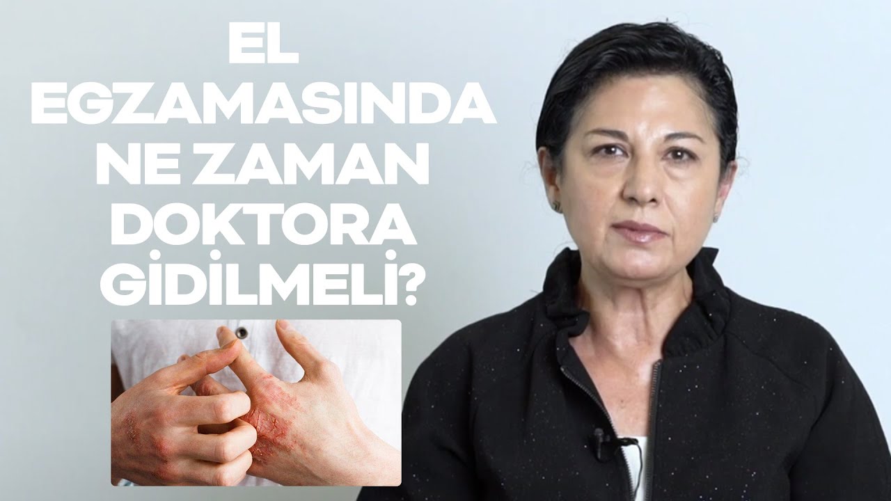 El Egzamasında Ne Zaman Doktora Gidilmeli? | Topicrem #egzama