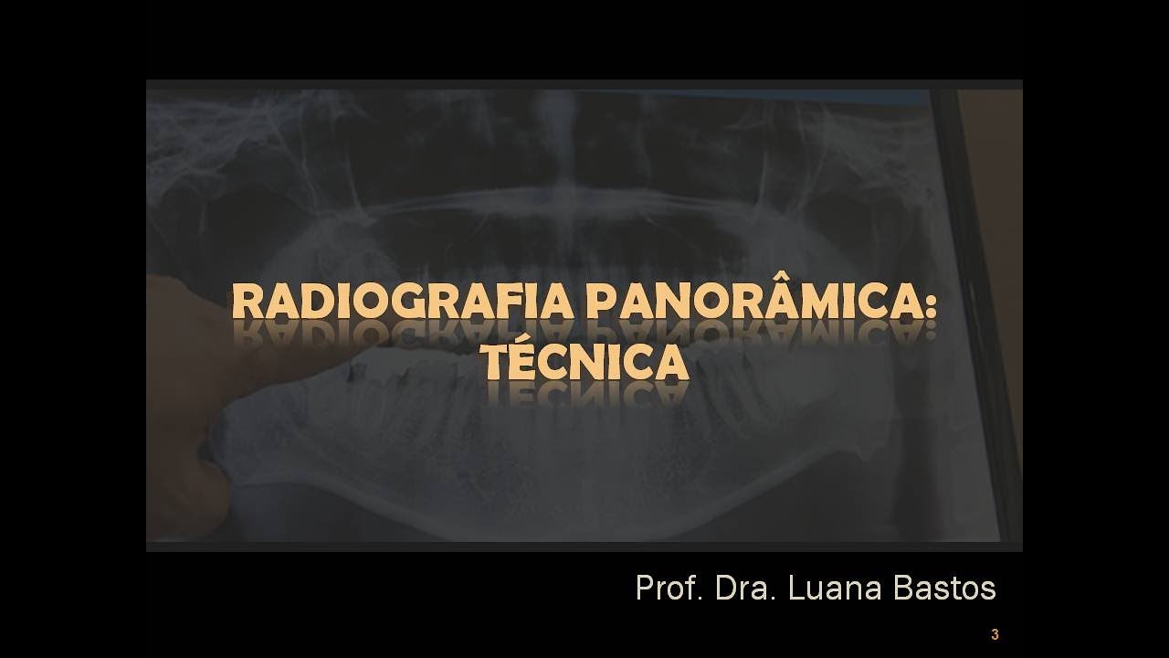 Aula Graduação Tecnólogo - Radiografia Panorâmica: Técnica