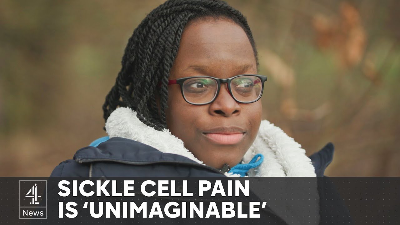 UK health: NHS approves groundbreaking sickle cell treatment