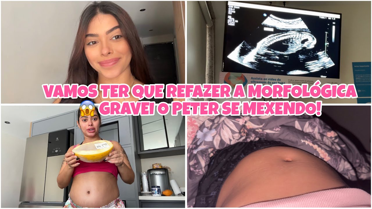 VAMOS TER QUE REFAZER A 2ª MORFOLÓGICA DO BEBÊ!! 😱 GRAVEI ELE SE MEXENDO MUITO! 😍 Lidiane Pícculi