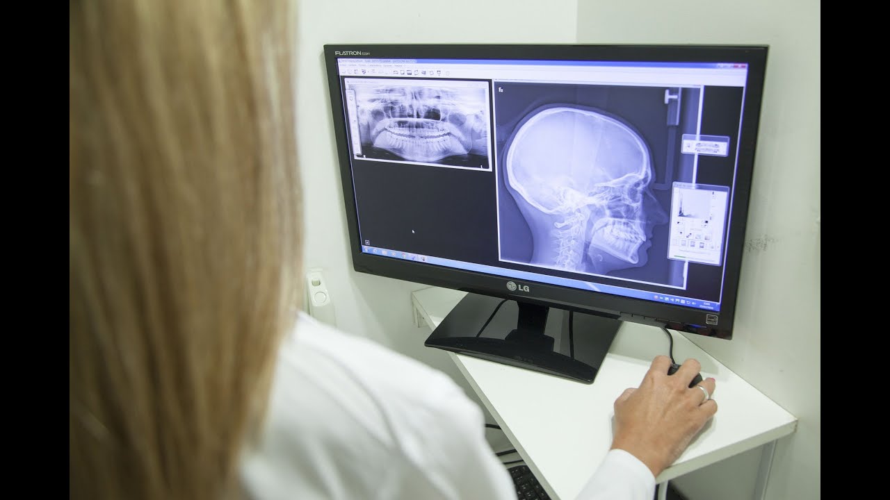La aplicación de la inteligencia artificial en la Salud 4.0 o eHealth