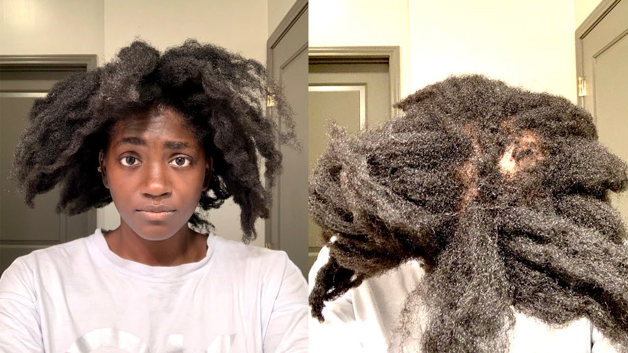 How my hair loss is REALLY affecting me.