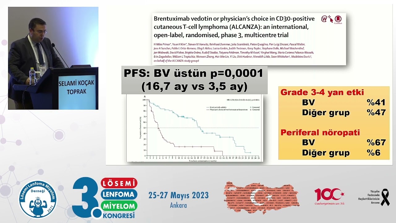 Mikozis Fungoides Hematoloji - Selami Koçak Toprak