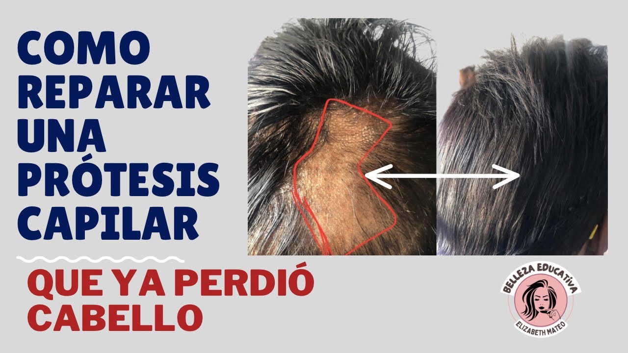 ¿TU PROTESIS CAPILAR PERDIO CABELLO? HAZ ESTO
