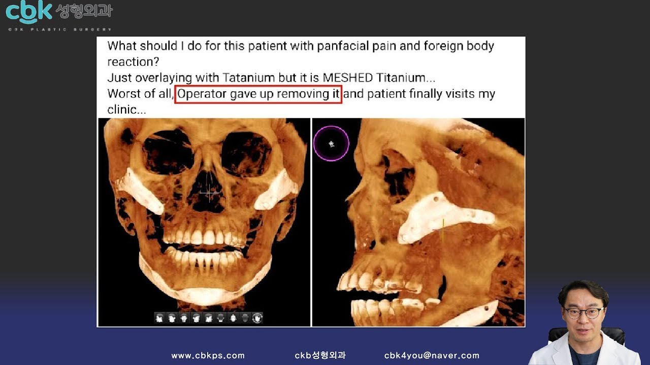 [기막힘 주의] 백원장님 방송 반박,성형외과 환자분과 원장님들께 당부 드립니다!