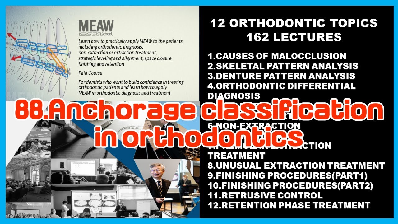 88.Anchorage classification in orthodontics