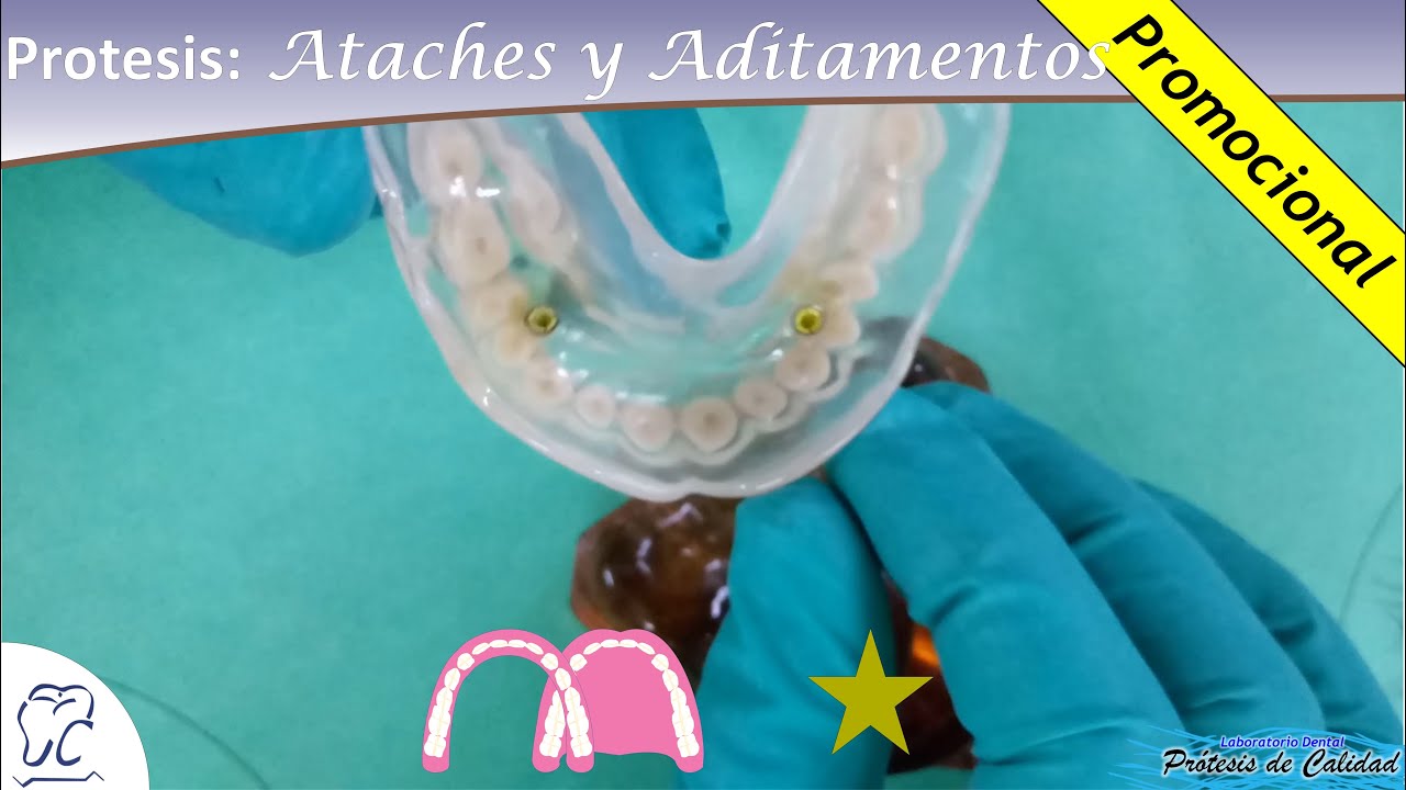 Protesis: Ataches y Aditamentos 04