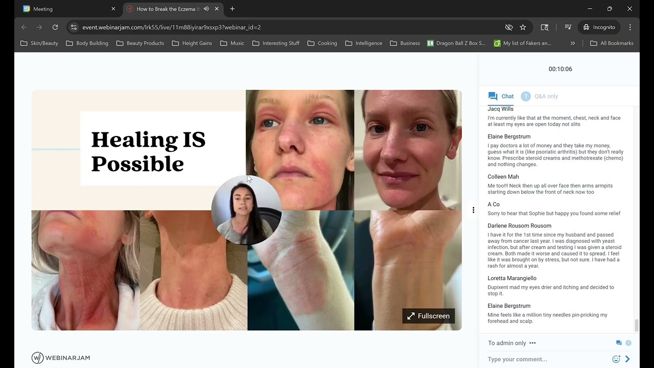 How to Break the Eczema Itch Scratch Cycle   Google Chrome 2026 02 22 14 45 25