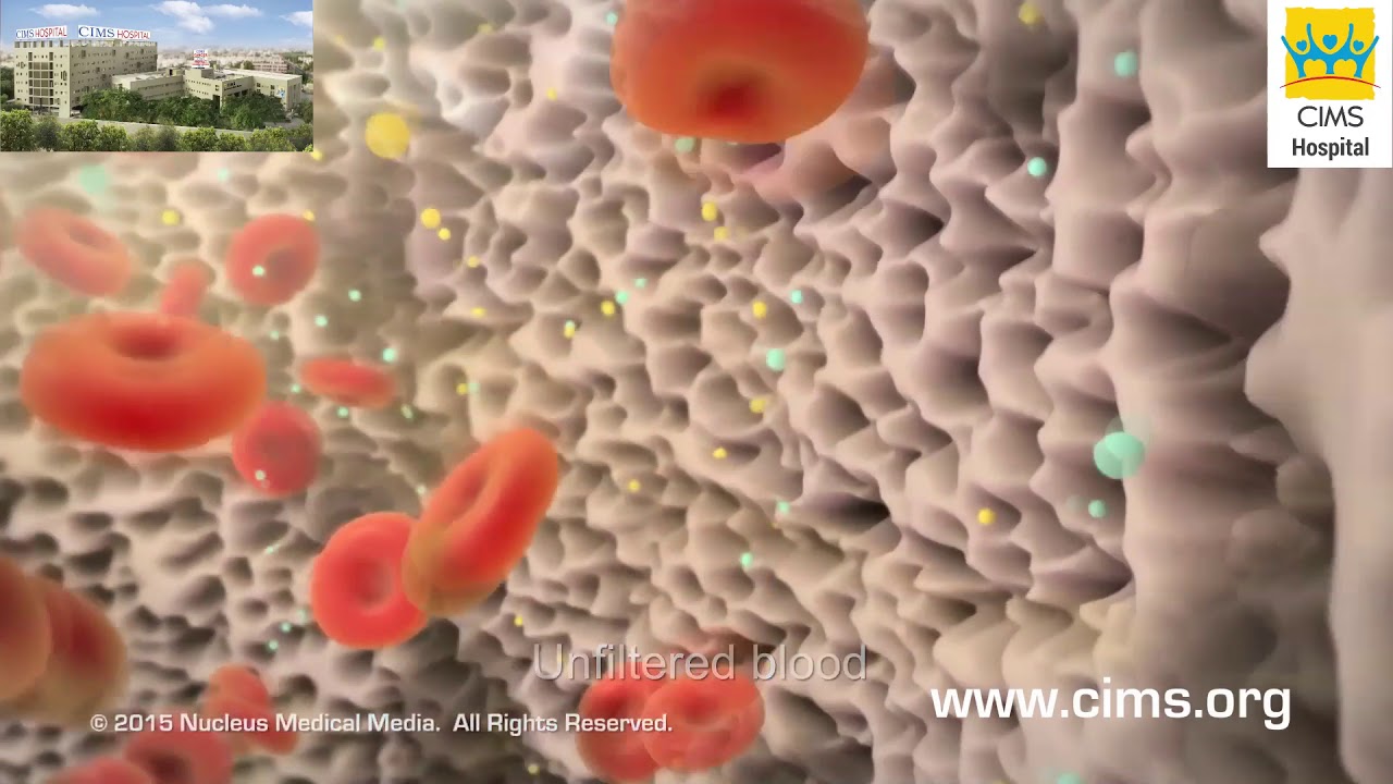 Dialysis (Hindi) - CIMS Hospital