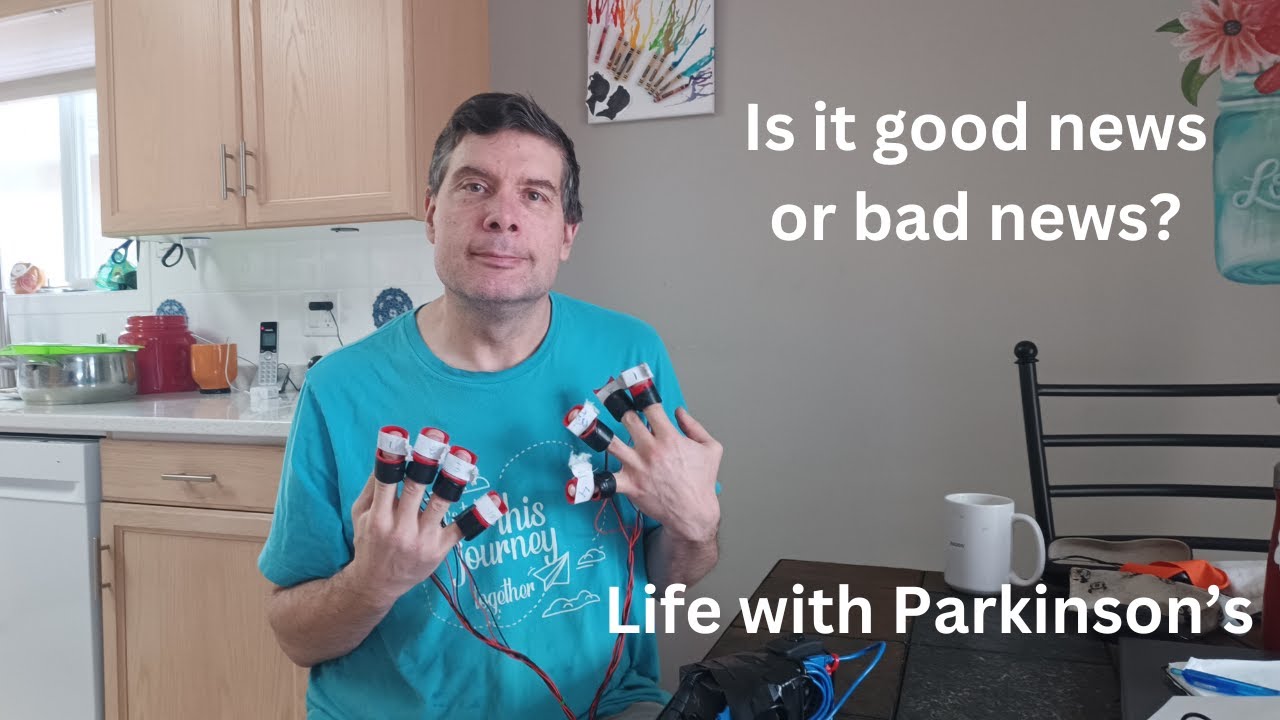 Parkinson’s vibration gloves: 6 month double update-homemade