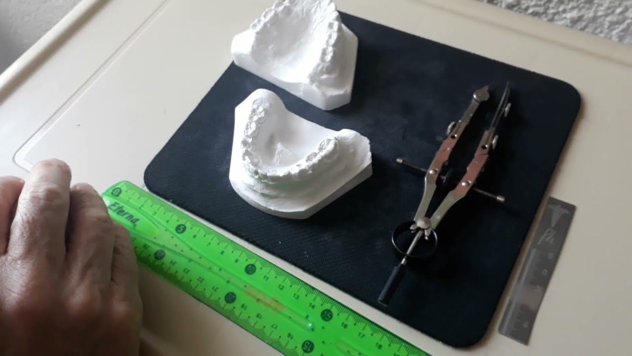Análisis de Moyers. Taller N°1. Tutorial 1. ANÁLISIS DENTAL.CCHAPARRO
