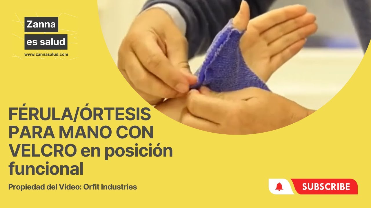 Elaboración de FÉRULA/ÓRTESIS PARA MANO CON VELCRO en posición funcional con Orficast