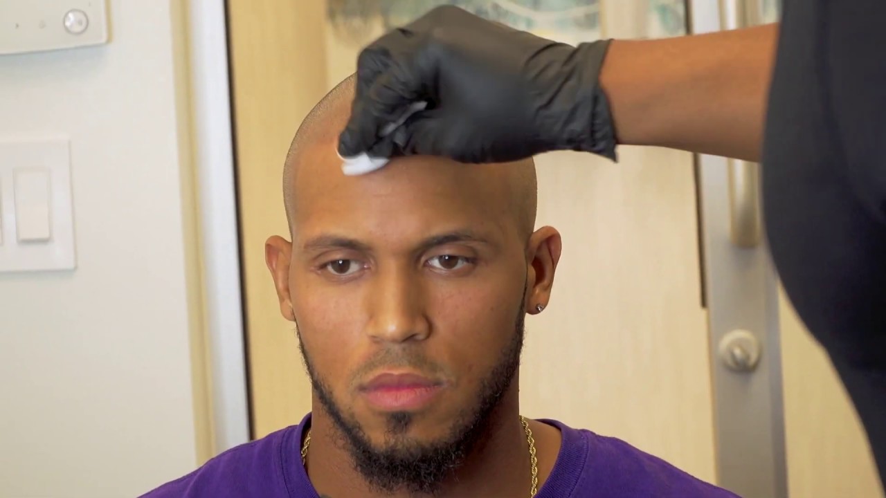 Best Scalp Micropigmentation in Atlanta at ATL Scalp Micro