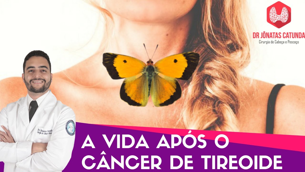 A vida após o câncer de tireóide - o que muda?