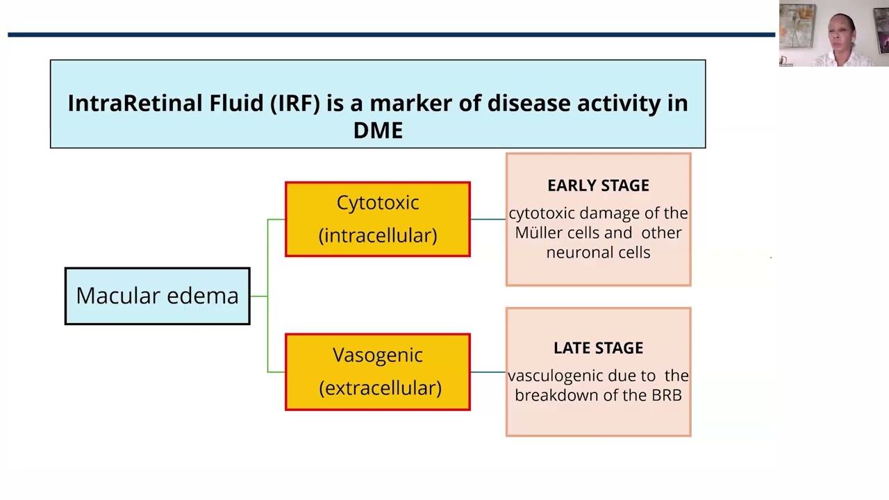 Lecture: OCT Retinal Biomarkers in Diabetic Retinopathy