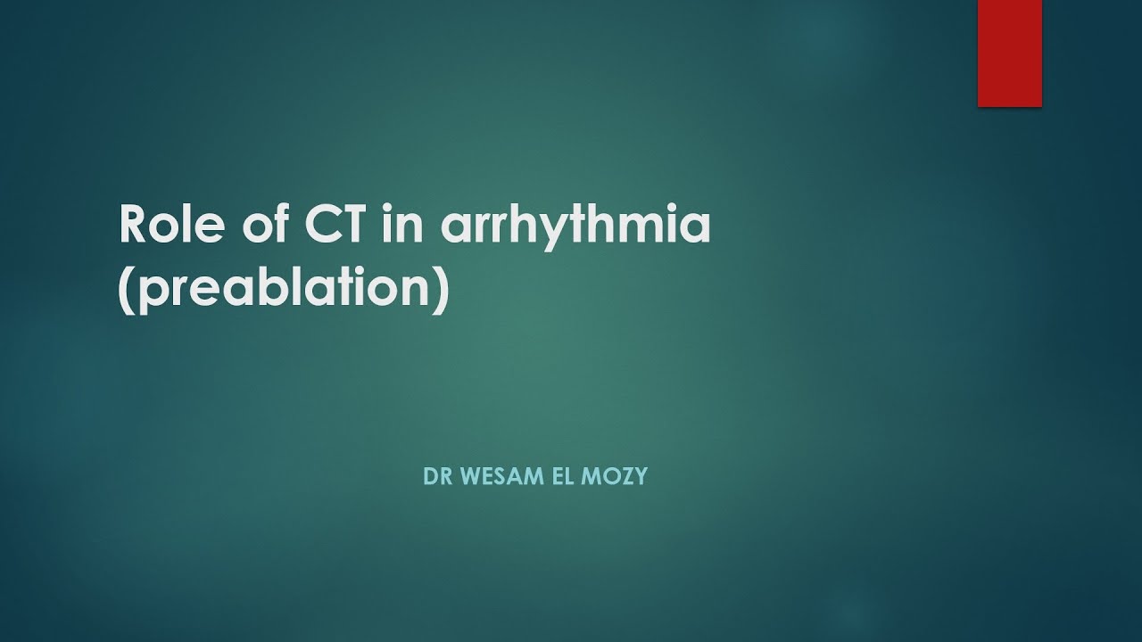 Role of CT in arrythmia (pre-ablation)