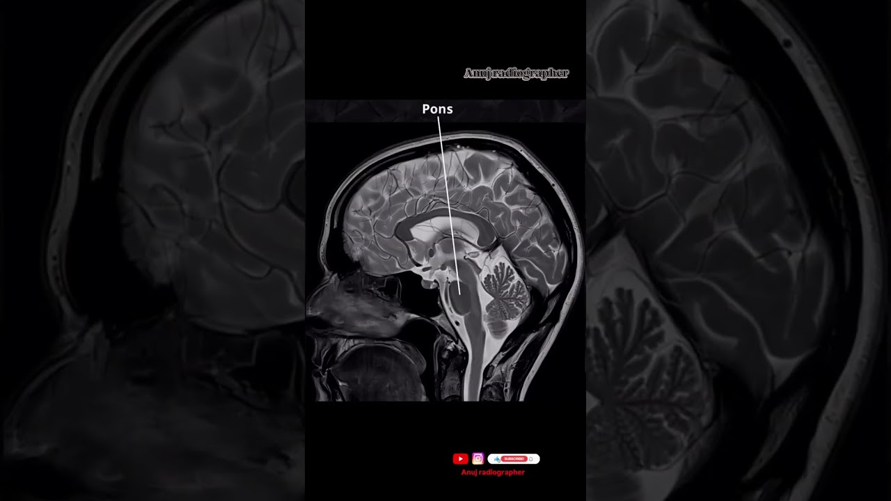 MRI BRAIN 🧠 ANATOMY !!