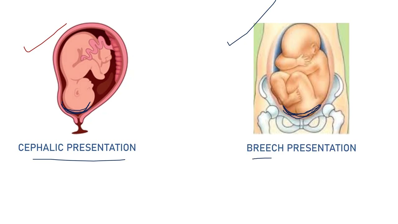 Fetal Lie | Fetal Presentation | Presenting Part | Attitude | Denominator | Position | In Bengali 