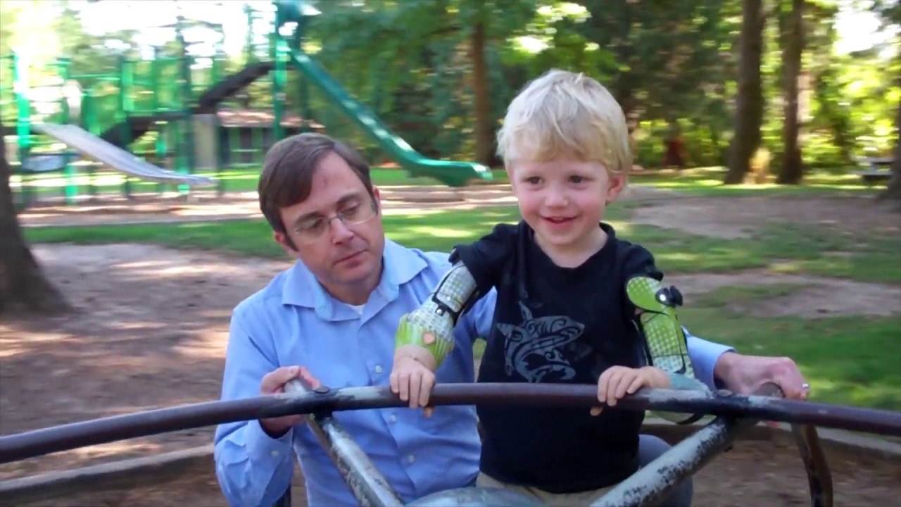 Arm Dynamics Pediatric Prosthetics