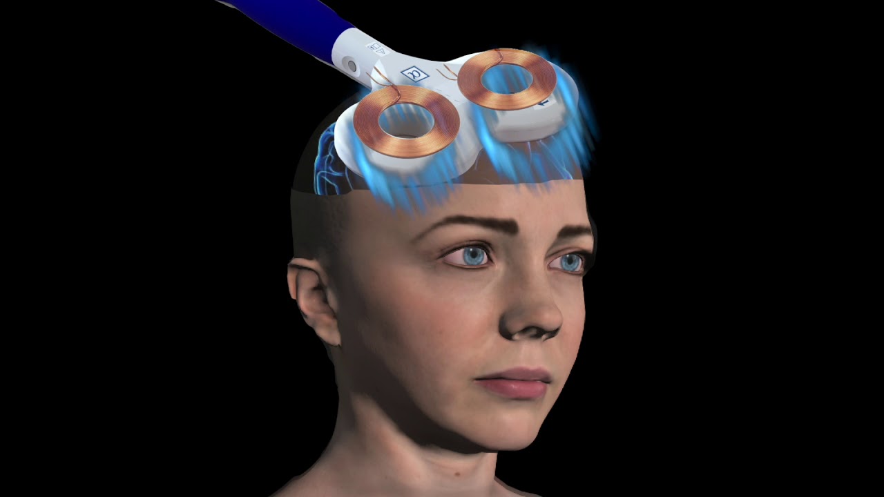 What is rTMS? Repetitive Transcranial Magnetic Stimulation