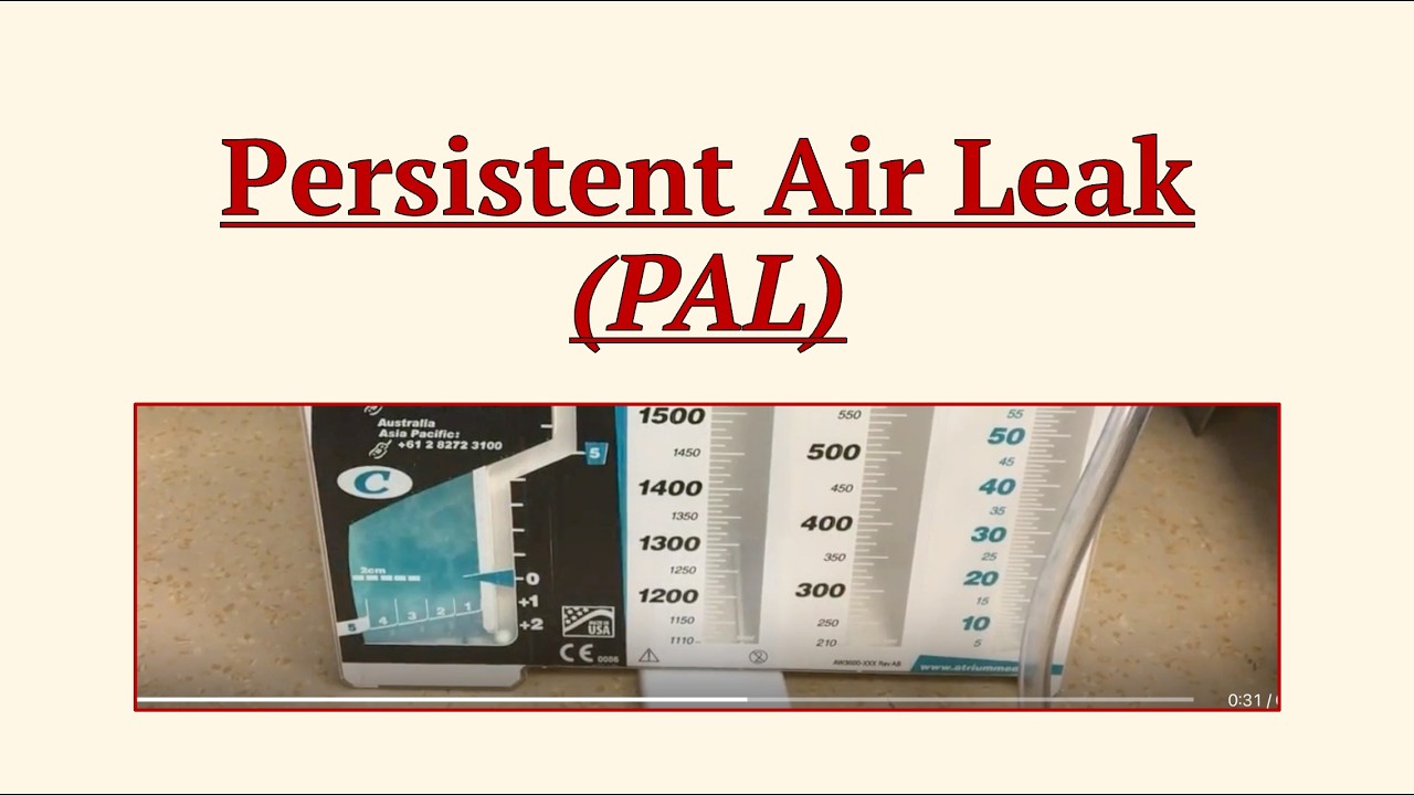 Persistent Air Leak (PAL) - Guideline Review 2025