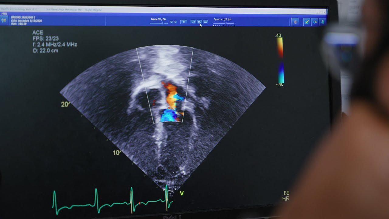 University of Florida Cardiology Fellowship Program