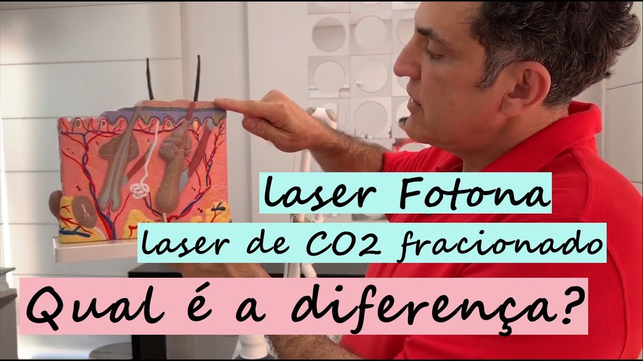 Você sabe a diferença entre o laser Fotona e o laser de CO2 fracionado?