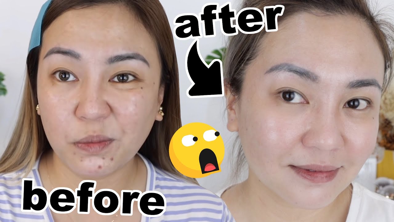 PAANO GUMALING ANG BREAKOUTS KO? SENSITIVE/IRRITATED SKINCARE ROUTINE
