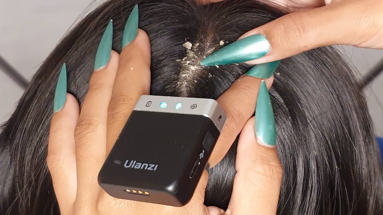 ASMR Scalp Check & Flake Pick 💆‍♀️ | Long Hair + Nail Scratching Sounds #033
