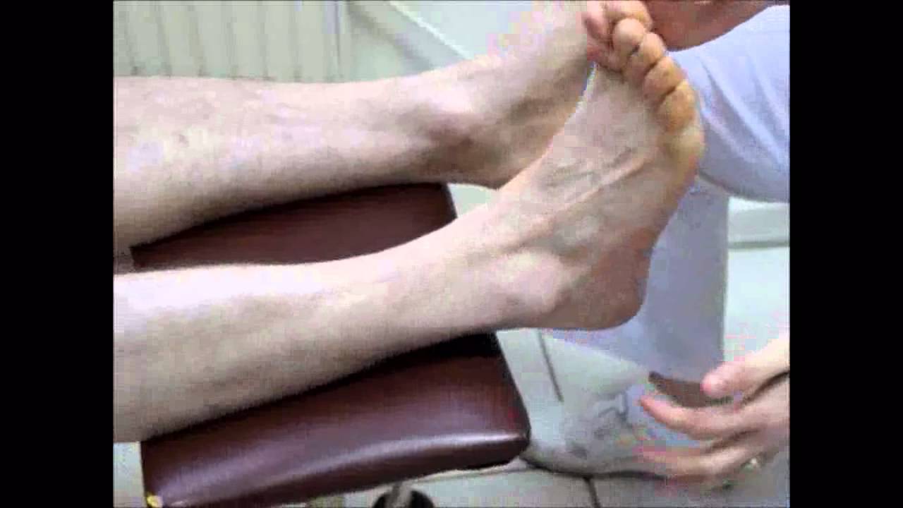 Diyabetlilerde ayak muayenesi Selda Çelik