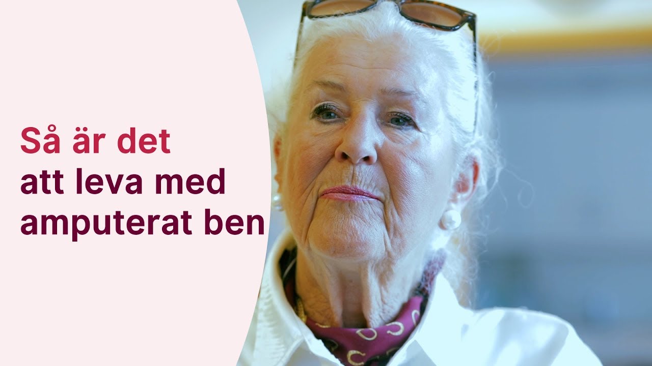 Så är det att leva med amputerat ben