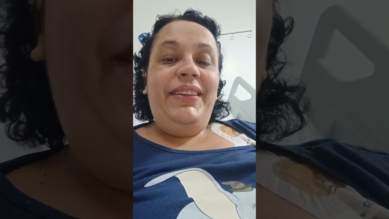 Transplante de medula óssea autólogo. 17° dia 3 dia de quimioterapia. 