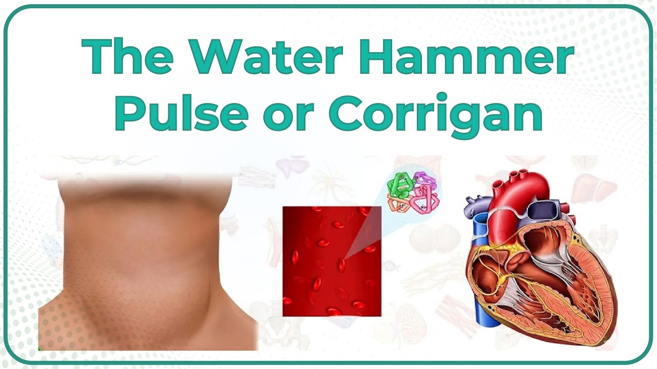 The water hammer pulse or Corrigan (hyperkinetic) pulse || #usmle cardiology