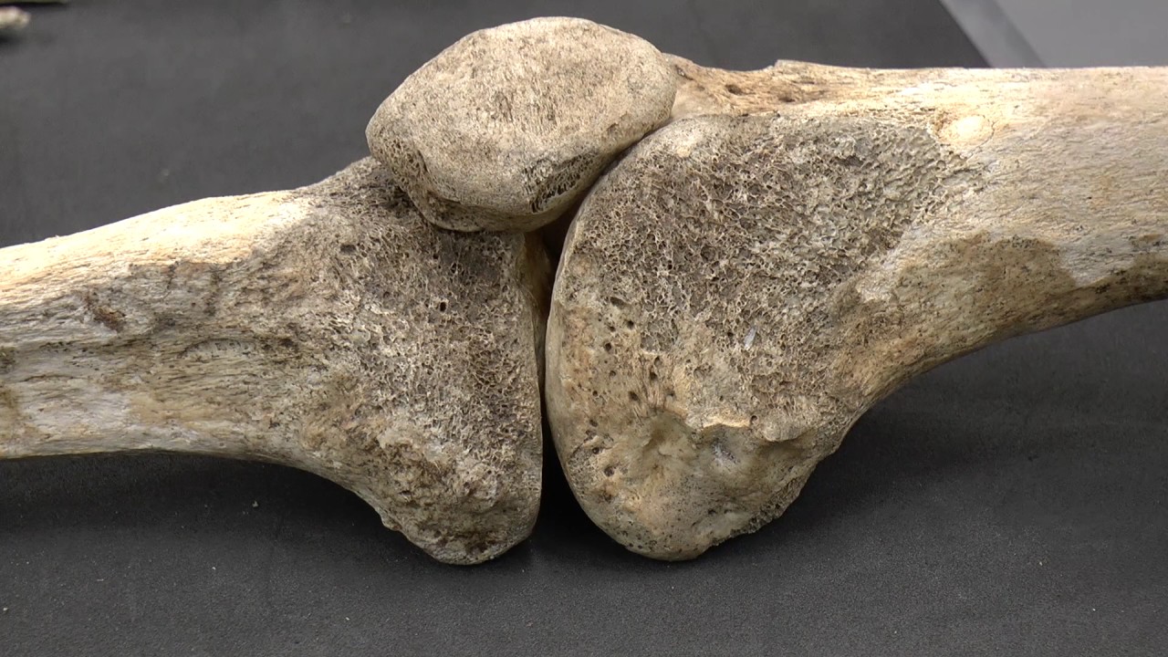 Life After Death  -  Conservation of an Anglo Saxon Skeleton