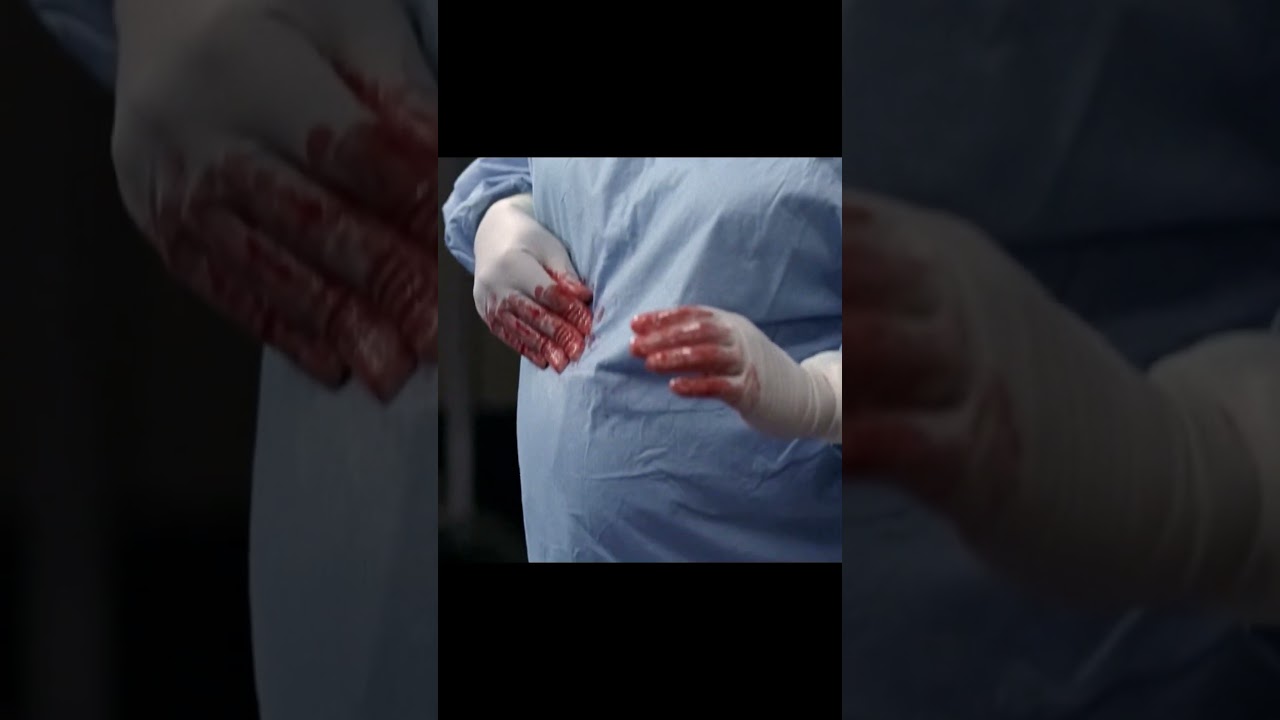 The doctor insisted on finishing the surgery while pregnant #greysanatomy #foryou #tvshow #shorts