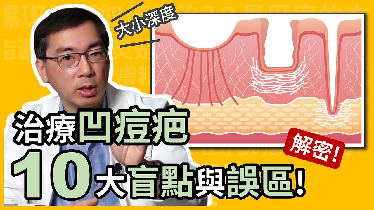 治療凹痘疤，10大盲點與誤區大公開！皮膚科林政賢醫師教你避免治療凹痘疤踩雷！