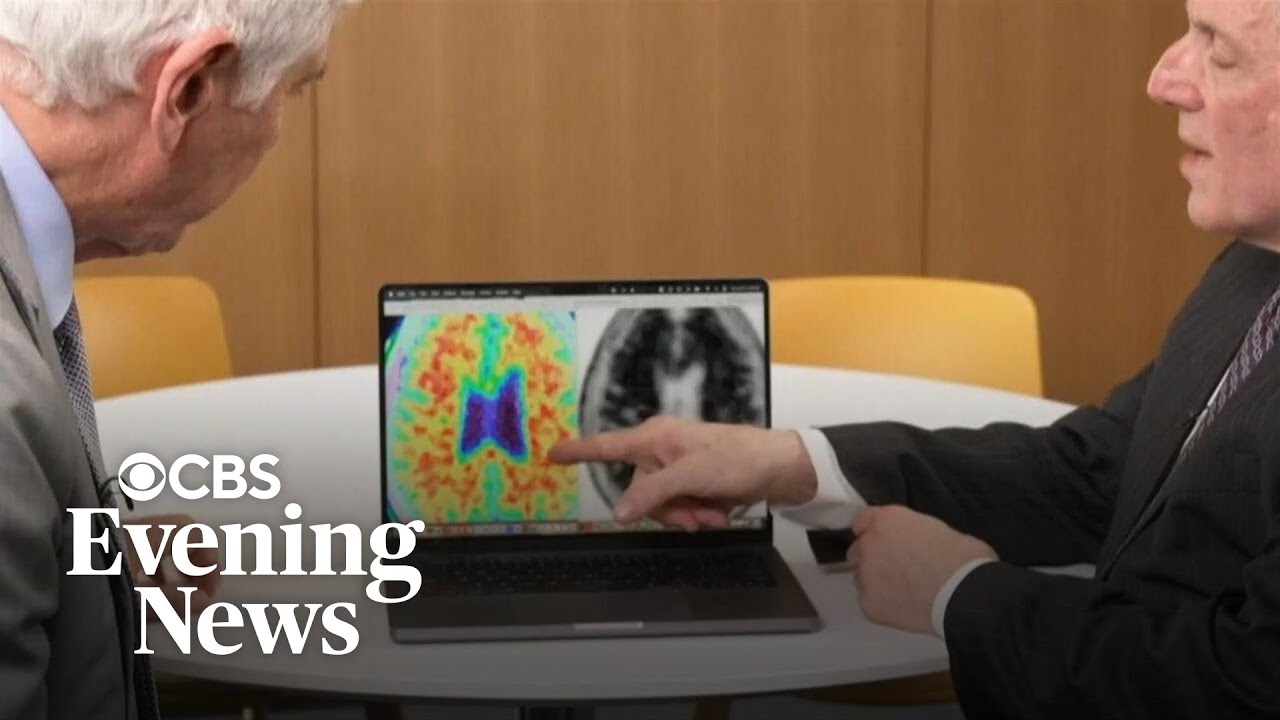 New drug brings hope for early Alzheimer's patients