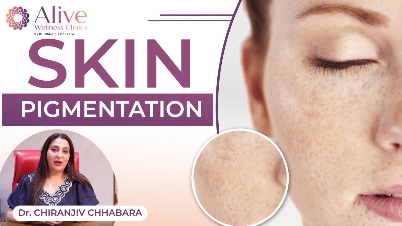 ✳️ Skin Pigmentation on Face By Doctor | ✅Causes and Treatment of Skin Pigmentation in Hindi