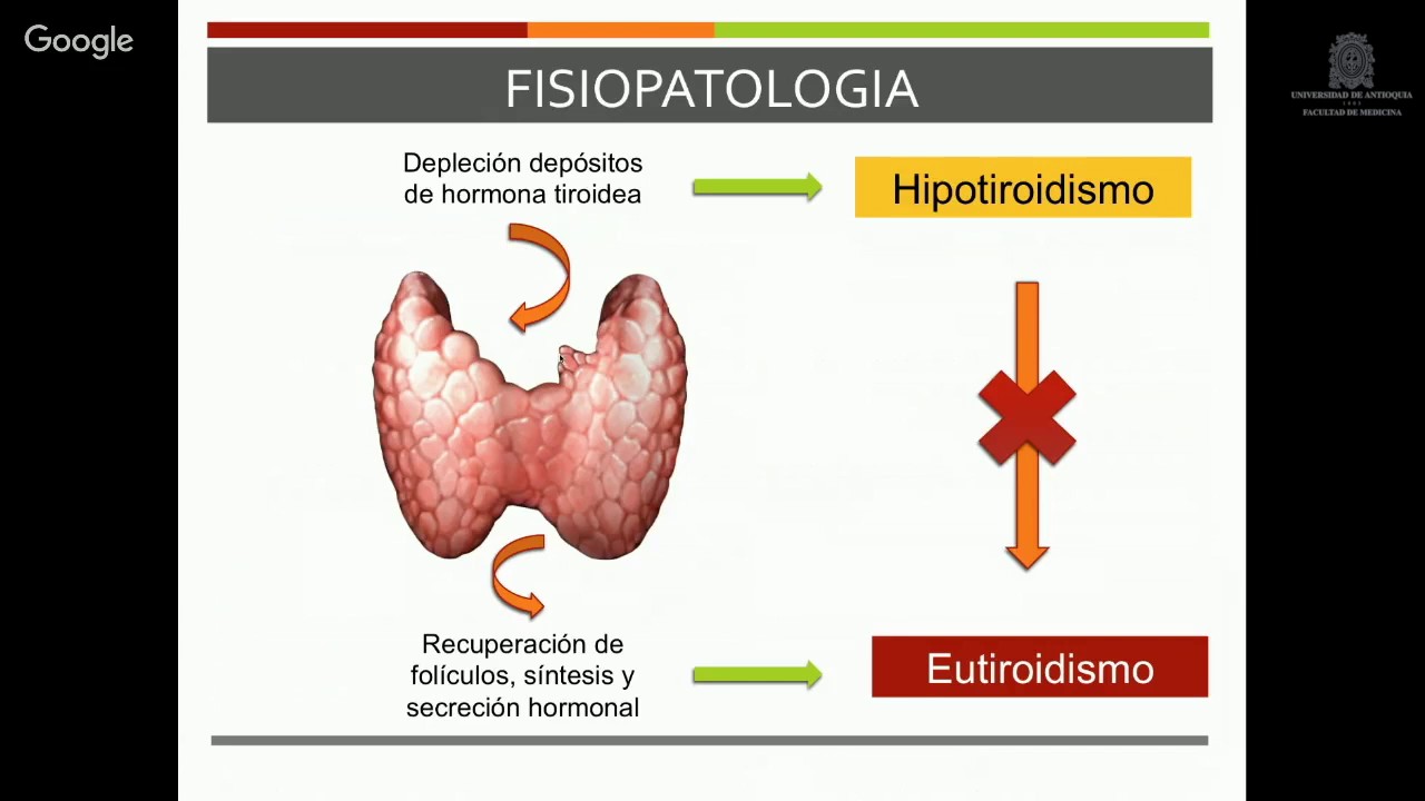 Tiroiditis