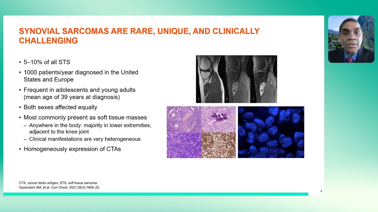 Adaptimmune's Symposium at CTOS 2021– “Spotlight on Synovial Sarcoma; Where are we now? Where next?”