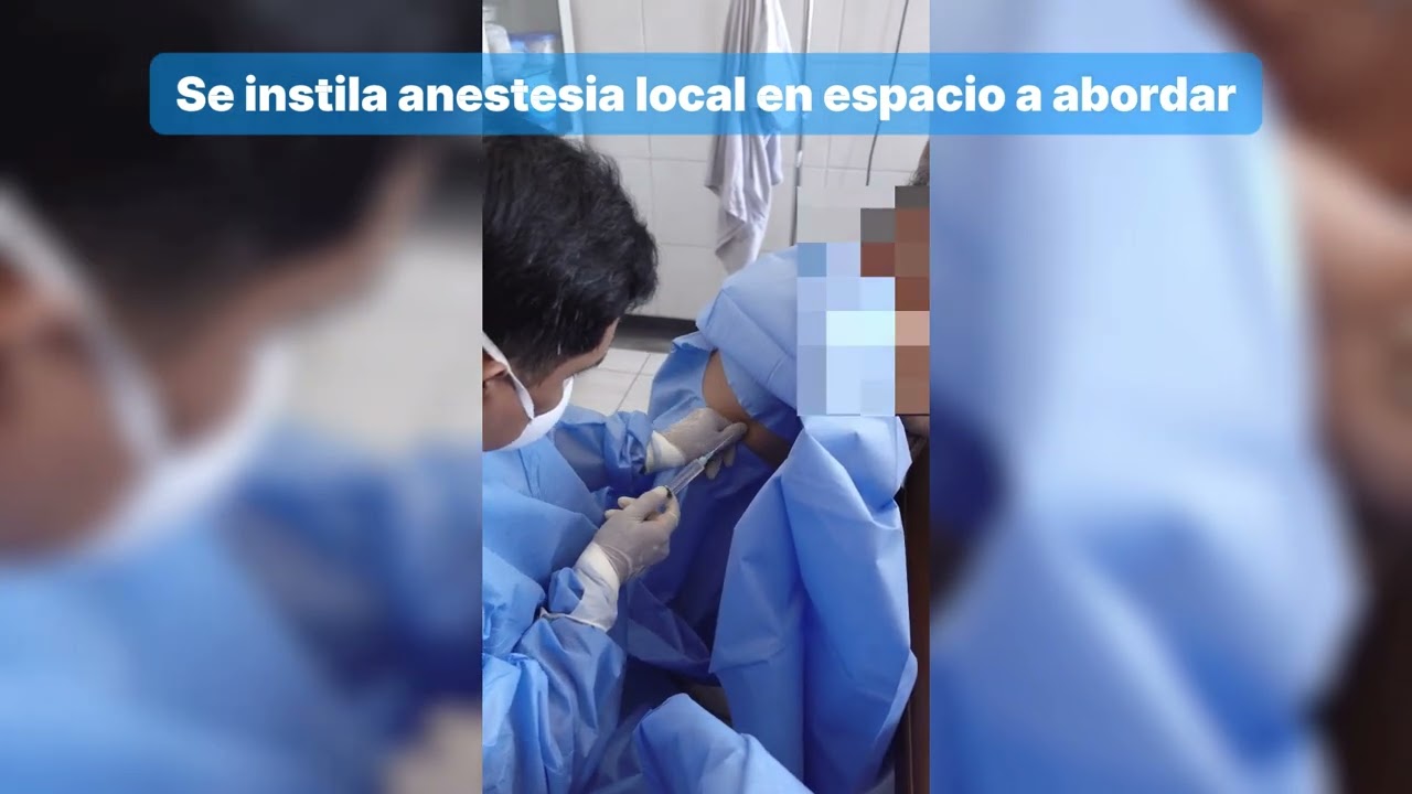COLOCACI&Oacute;N DE TUBO DE DRENAJE PLEURAL