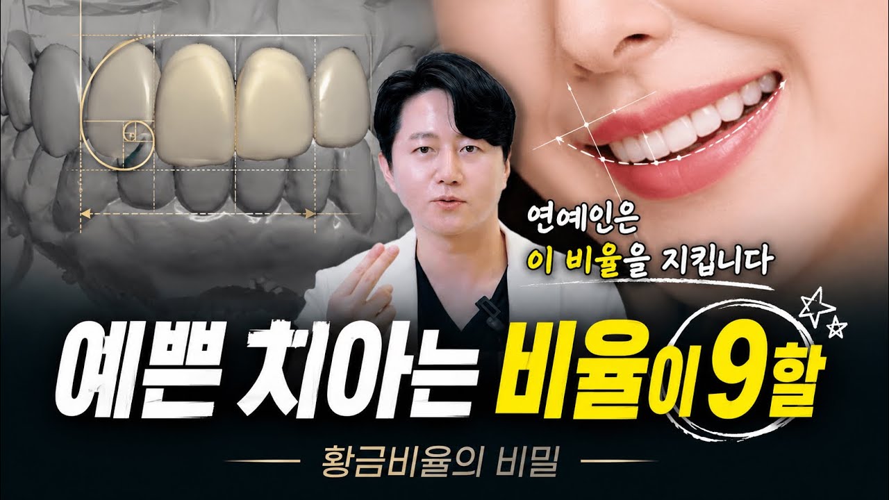 연예인과 일반인의 라미네이트 차이 (2) 황금 비율로 토끼 이빨을 피하는 방법 #토끼이빨 #입툭튀