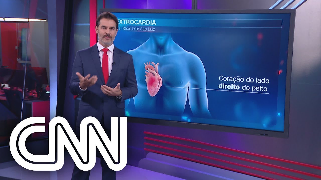 Mulher com coração do lado direito realiza cirurgia inédita no Brasil - Correspondente Médico