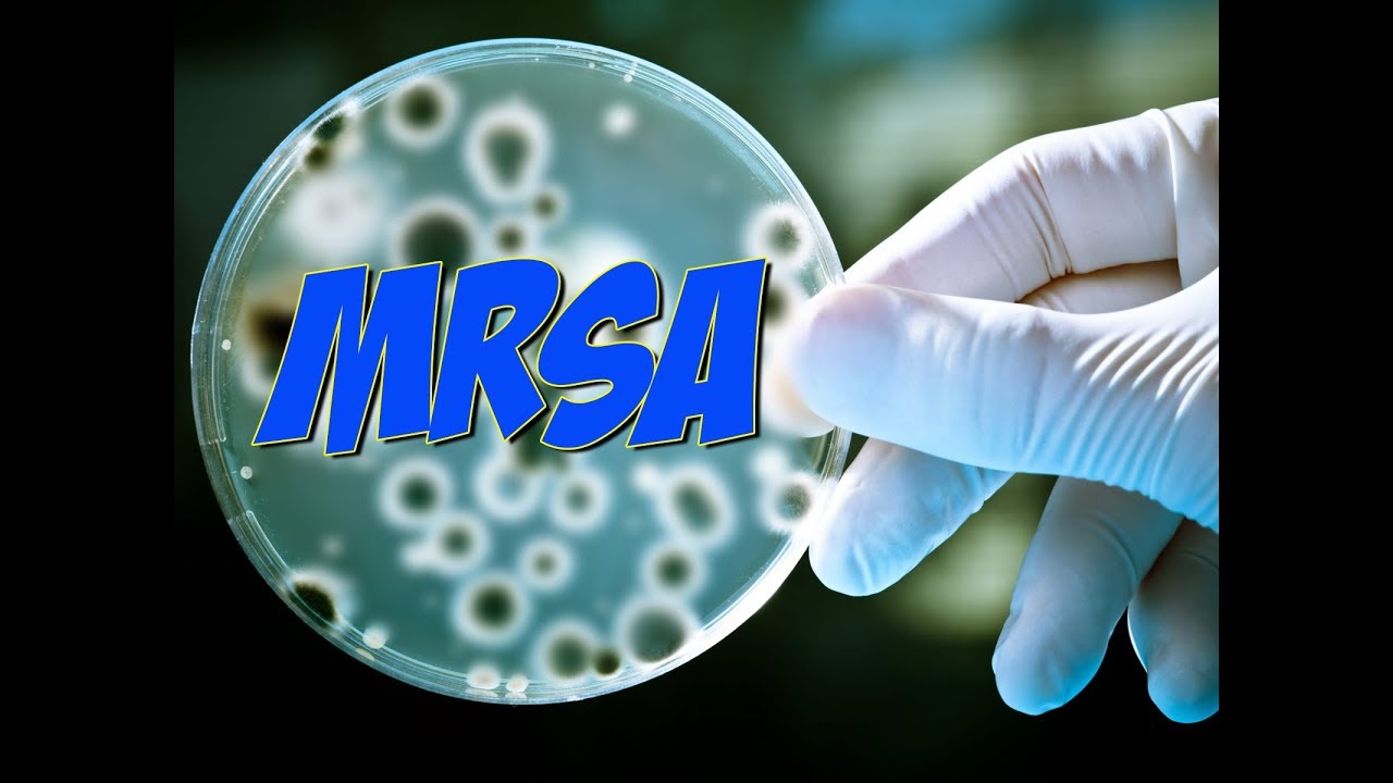 MRSA