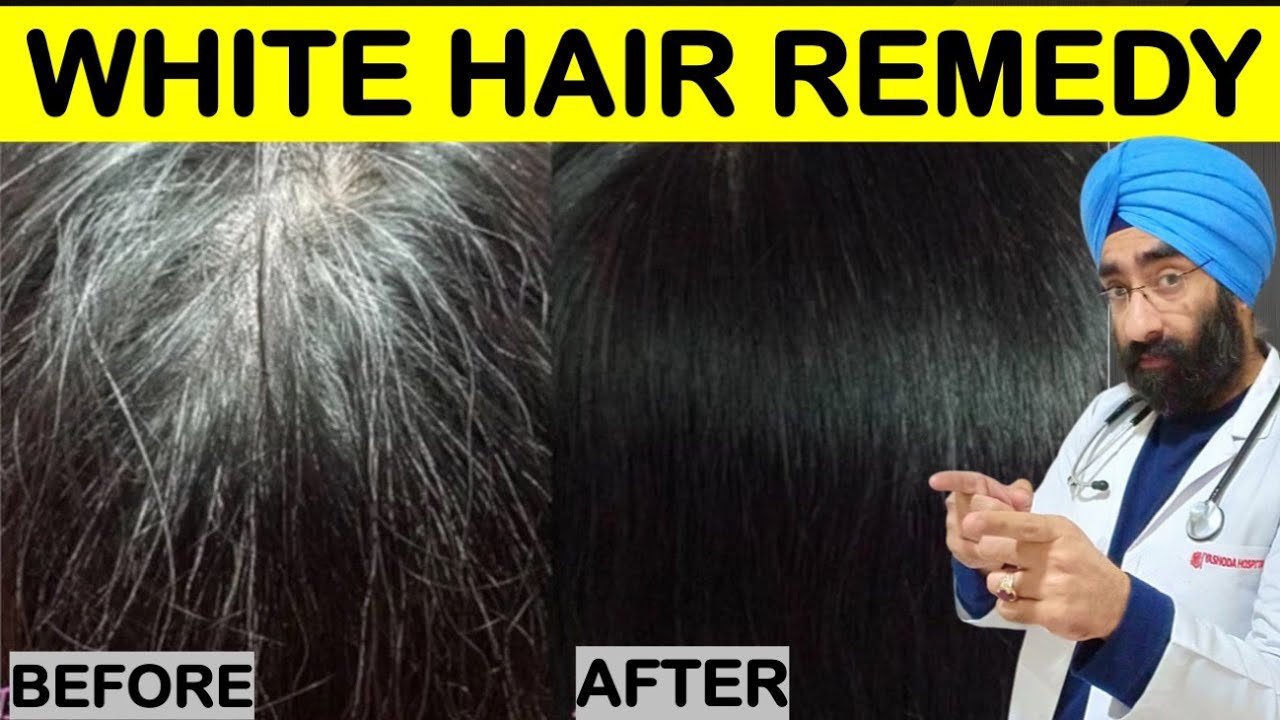 सफ़ेद बाल आ रहे है ? | I have WHITE HAIR | GREY HAIR Problems | Home Remedy | Dr.Education