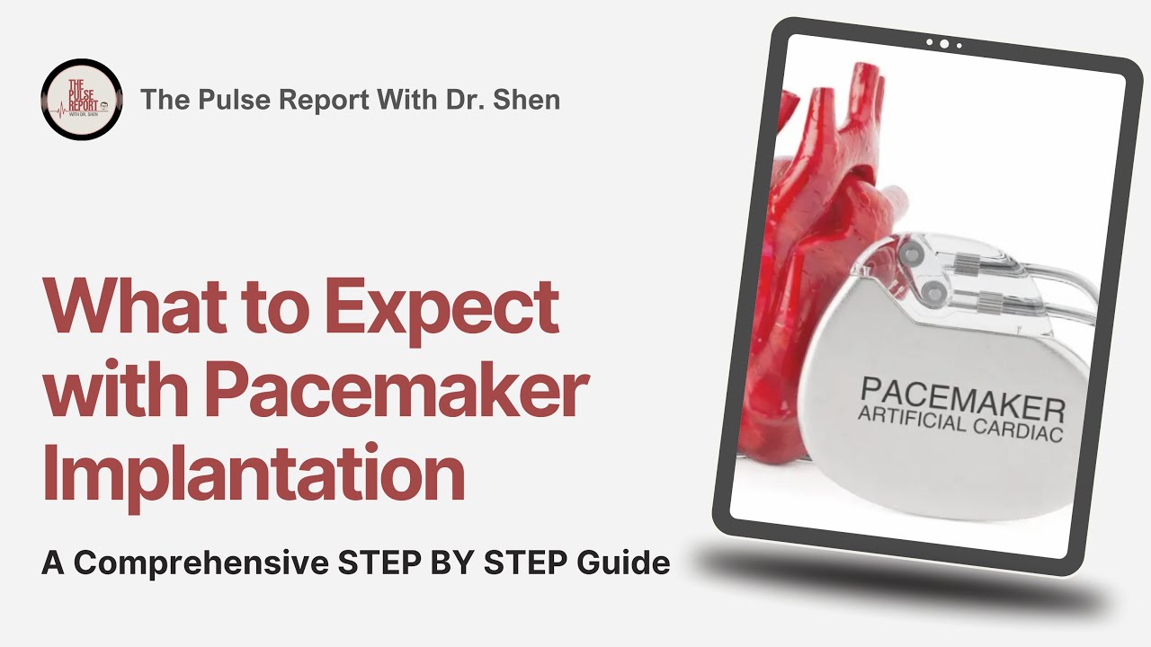 Pacemaker Implantation Guide for Patients: What to Expect Before, During & After the Procedure