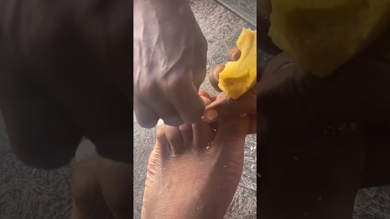 ASMR: Local scissors nail cutting on street.(Local Pedicure and Manicure) #Asmr #asmrsounds