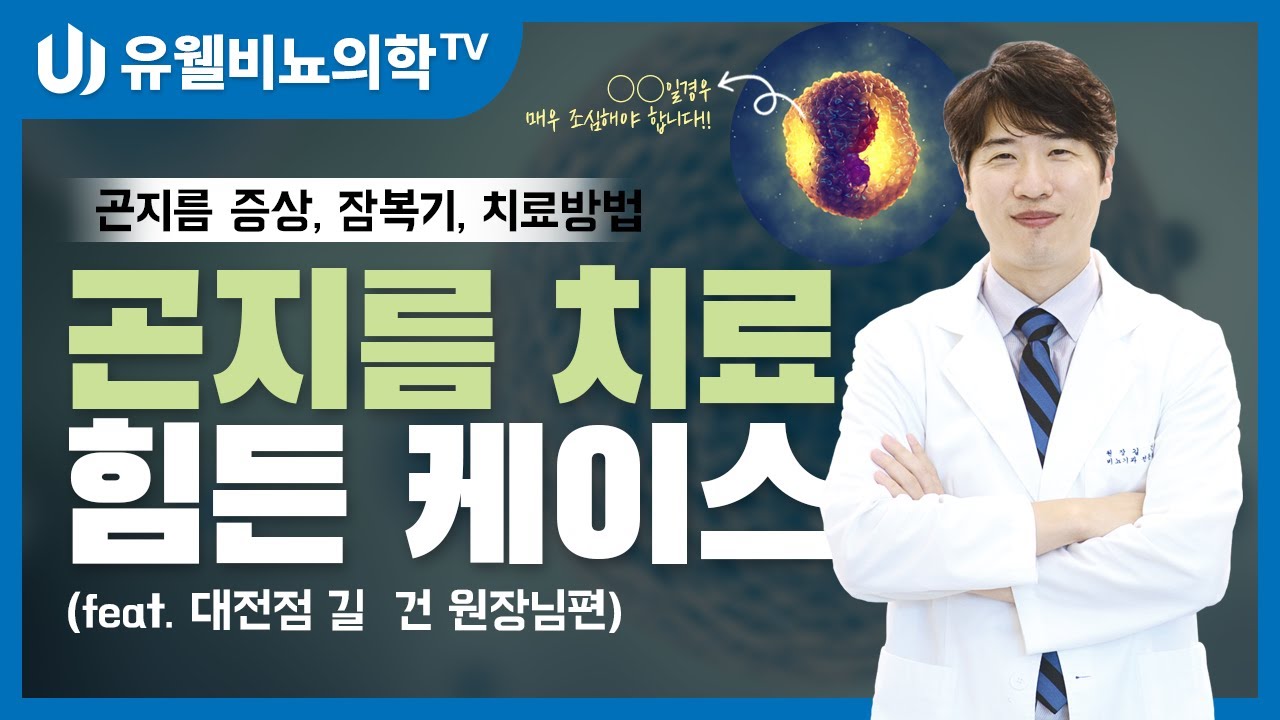 곤지름 치료 힘든 케이스에 대해 알아봅니다.