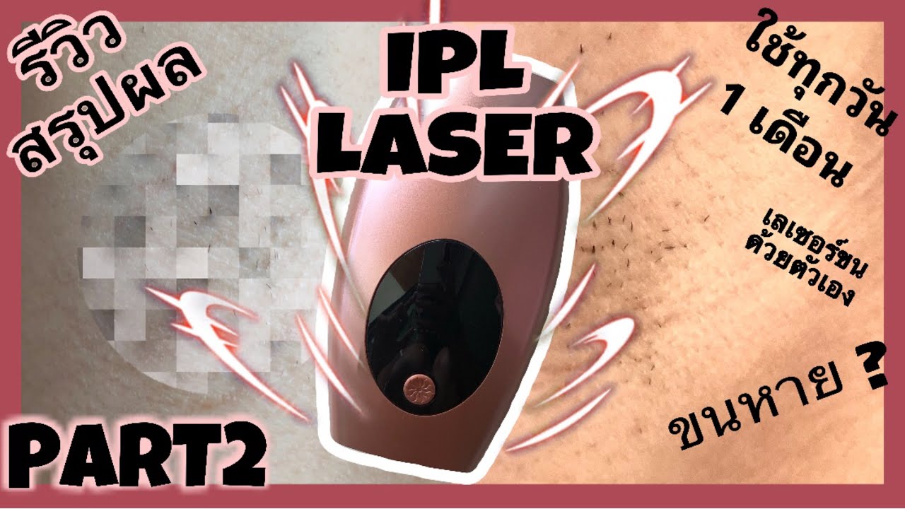 Part2 สรุปผล เลเซอร์ขนรักแร้เองที่บ้านด้วยเครื่อง IPL Laser | Tangthai Nitt